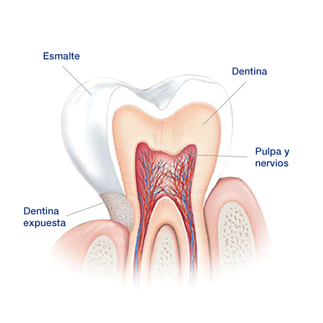 causas sensibilidad dental